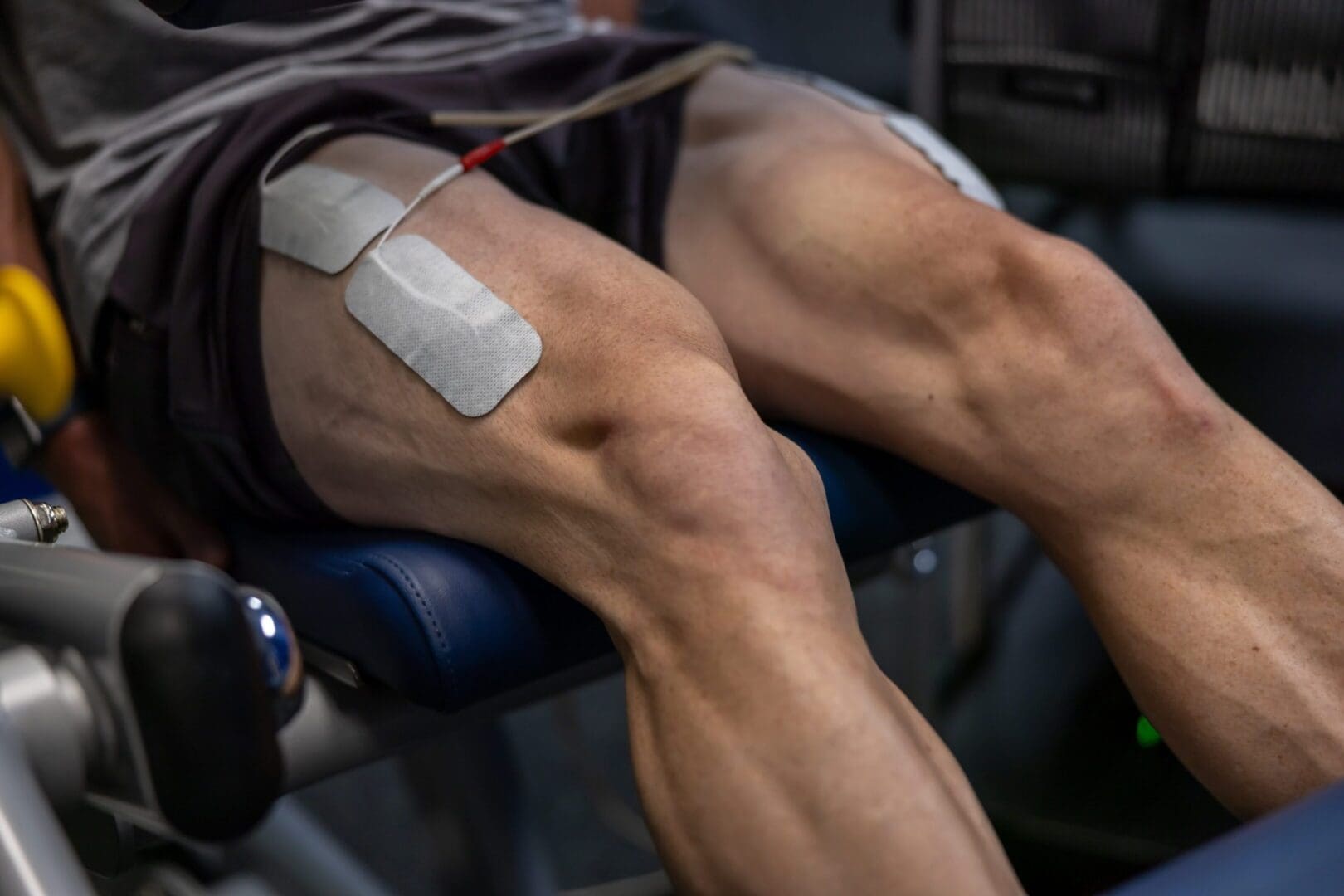 Person receiving physical therapy with electrodes.